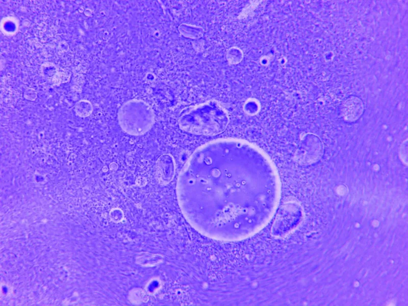 Timing Is Everything: How Morphokinetics and Time-Lapse Technology Are Redefining Embryo Selection